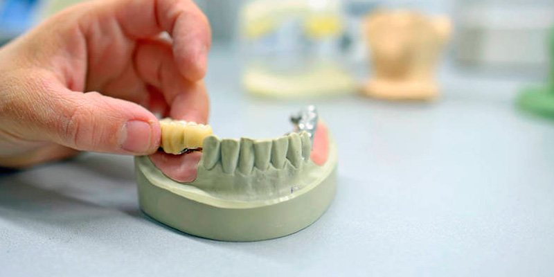 elaboración de prótesis dental removible